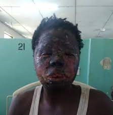 Husband jailed 17 years for scalding wife Husband jailed 17 years for scalding wife